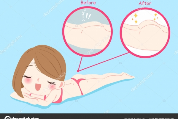 SAUNA FINLANDESE per RITENZIONE IDRICA E  CELLULITE